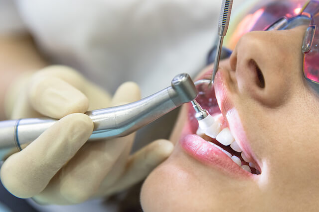 Dental Implants Singapore Cost